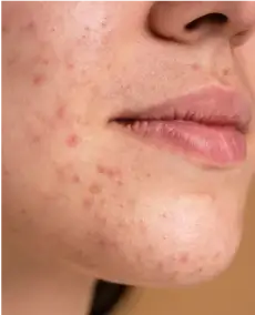 img2