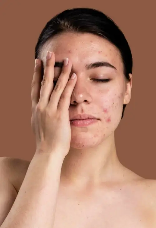 Benefits of Cosmetic Dermatology